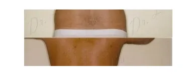 156 üzleti kép ZSÍRLESZÍVÁS KLINIKA DR LÁNYI CECÍLIA Plasztikai sebészet ban/ben Budapest