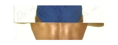 157 üzleti kép ZSÍRLESZÍVÁS KLINIKA DR LÁNYI CECÍLIA Plasztikai sebészet ban/ben Budapest