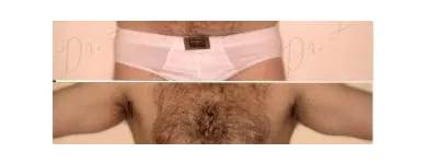 159 üzleti kép ZSÍRLESZÍVÁS KLINIKA DR LÁNYI CECÍLIA Plasztikai sebészet ban/ben Budapest