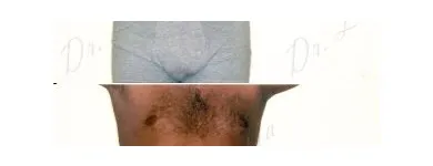 160 üzleti kép ZSÍRLESZÍVÁS KLINIKA DR LÁNYI CECÍLIA Plasztikai sebészet ban/ben Budapest