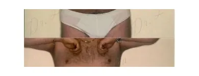 161 üzleti kép ZSÍRLESZÍVÁS KLINIKA DR LÁNYI CECÍLIA Plasztikai sebészet ban/ben Budapest