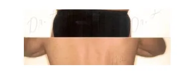 162 üzleti kép ZSÍRLESZÍVÁS KLINIKA DR LÁNYI CECÍLIA Plasztikai sebészet ban/ben Budapest