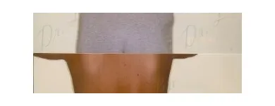 163 üzleti kép ZSÍRLESZÍVÁS KLINIKA DR LÁNYI CECÍLIA Plasztikai sebészet ban/ben Budapest