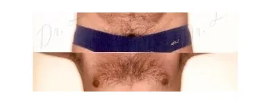 165 üzleti kép ZSÍRLESZÍVÁS KLINIKA DR LÁNYI CECÍLIA Plasztikai sebészet ban/ben Budapest