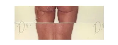 167 üzleti kép ZSÍRLESZÍVÁS KLINIKA DR LÁNYI CECÍLIA Plasztikai sebészet ban/ben Budapest