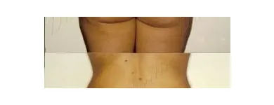 172 üzleti kép ZSÍRLESZÍVÁS KLINIKA DR LÁNYI CECÍLIA Plasztikai sebészet ban/ben Budapest