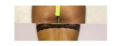 173 üzleti kép ZSÍRLESZÍVÁS KLINIKA DR LÁNYI CECÍLIA Plasztikai sebészet ban/ben Budapest