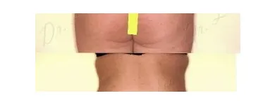 174 üzleti kép ZSÍRLESZÍVÁS KLINIKA DR LÁNYI CECÍLIA Plasztikai sebészet ban/ben Budapest