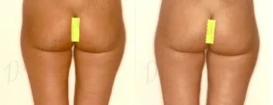 181 üzleti kép ZSÍRLESZÍVÁS KLINIKA DR LÁNYI CECÍLIA Plasztikai sebészet ban/ben Budapest