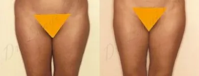 183 üzleti kép ZSÍRLESZÍVÁS KLINIKA DR LÁNYI CECÍLIA Plasztikai sebészet ban/ben Budapest