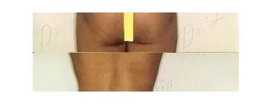 184 üzleti kép ZSÍRLESZÍVÁS KLINIKA DR LÁNYI CECÍLIA Plasztikai sebészet ban/ben Budapest