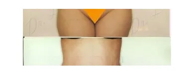 185 üzleti kép ZSÍRLESZÍVÁS KLINIKA DR LÁNYI CECÍLIA Plasztikai sebészet ban/ben Budapest