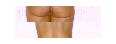 187 üzleti kép ZSÍRLESZÍVÁS KLINIKA DR LÁNYI CECÍLIA Plasztikai sebészet ban/ben Budapest