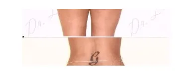 188 üzleti kép ZSÍRLESZÍVÁS KLINIKA DR LÁNYI CECÍLIA Plasztikai sebészet ban/ben Budapest