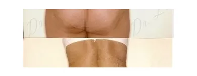 191 üzleti kép ZSÍRLESZÍVÁS KLINIKA DR LÁNYI CECÍLIA Plasztikai sebészet ban/ben Budapest