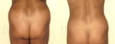 193 üzleti kép ZSÍRLESZÍVÁS KLINIKA DR LÁNYI CECÍLIA Plasztikai sebészet ban/ben Budapest