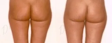 194 üzleti kép ZSÍRLESZÍVÁS KLINIKA DR LÁNYI CECÍLIA Plasztikai sebészet ban/ben Budapest