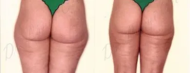 196 üzleti kép ZSÍRLESZÍVÁS KLINIKA DR LÁNYI CECÍLIA Plasztikai sebészet ban/ben Budapest