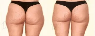 199 üzleti kép ZSÍRLESZÍVÁS KLINIKA DR LÁNYI CECÍLIA Plasztikai sebészet ban/ben Budapest