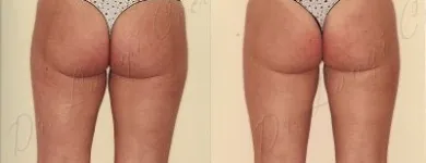 204 üzleti kép ZSÍRLESZÍVÁS KLINIKA DR LÁNYI CECÍLIA Plasztikai sebészet ban/ben Budapest