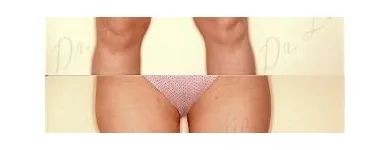 205 üzleti kép ZSÍRLESZÍVÁS KLINIKA DR LÁNYI CECÍLIA Plasztikai sebészet ban/ben Budapest