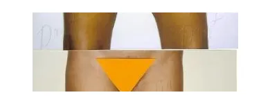 209 üzleti kép ZSÍRLESZÍVÁS KLINIKA DR LÁNYI CECÍLIA Plasztikai sebészet ban/ben Budapest