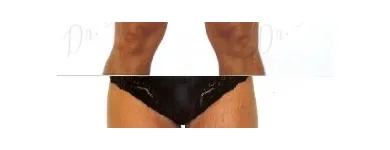 210 üzleti kép ZSÍRLESZÍVÁS KLINIKA DR LÁNYI CECÍLIA Plasztikai sebészet ban/ben Budapest