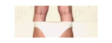 213 üzleti kép ZSÍRLESZÍVÁS KLINIKA DR LÁNYI CECÍLIA Plasztikai sebészet ban/ben Budapest