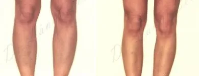 217 üzleti kép ZSÍRLESZÍVÁS KLINIKA DR LÁNYI CECÍLIA Plasztikai sebészet ban/ben Budapest