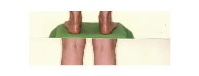 219 üzleti kép ZSÍRLESZÍVÁS KLINIKA DR LÁNYI CECÍLIA Plasztikai sebészet ban/ben Budapest