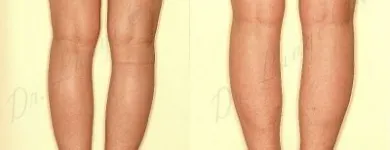 221 üzleti kép ZSÍRLESZÍVÁS KLINIKA DR LÁNYI CECÍLIA Plasztikai sebészet ban/ben Budapest