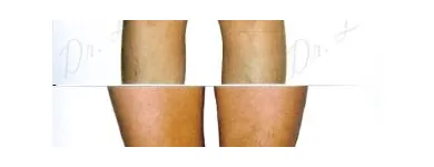 224 üzleti kép ZSÍRLESZÍVÁS KLINIKA DR LÁNYI CECÍLIA Plasztikai sebészet ban/ben Budapest