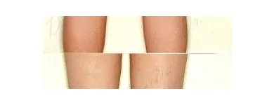 226 üzleti kép ZSÍRLESZÍVÁS KLINIKA DR LÁNYI CECÍLIA Plasztikai sebészet ban/ben Budapest