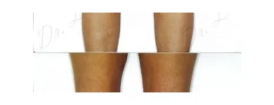 227 üzleti kép ZSÍRLESZÍVÁS KLINIKA DR LÁNYI CECÍLIA Plasztikai sebészet ban/ben Budapest