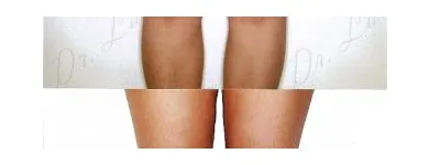 228 üzleti kép ZSÍRLESZÍVÁS KLINIKA DR LÁNYI CECÍLIA Plasztikai sebészet ban/ben Budapest