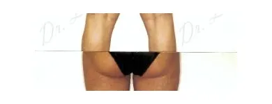 230 üzleti kép ZSÍRLESZÍVÁS KLINIKA DR LÁNYI CECÍLIA Plasztikai sebészet ban/ben Budapest