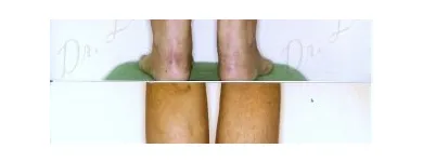 231 üzleti kép ZSÍRLESZÍVÁS KLINIKA DR LÁNYI CECÍLIA Plasztikai sebészet ban/ben Budapest