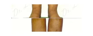 232 üzleti kép ZSÍRLESZÍVÁS KLINIKA DR LÁNYI CECÍLIA Plasztikai sebészet ban/ben Budapest