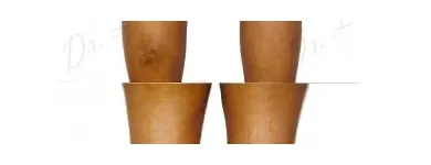 233 üzleti kép ZSÍRLESZÍVÁS KLINIKA DR LÁNYI CECÍLIA Plasztikai sebészet ban/ben Budapest