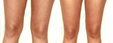 235 üzleti kép ZSÍRLESZÍVÁS KLINIKA DR LÁNYI CECÍLIA Plasztikai sebészet ban/ben Budapest