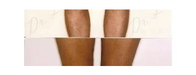 238 üzleti kép ZSÍRLESZÍVÁS KLINIKA DR LÁNYI CECÍLIA Plasztikai sebészet ban/ben Budapest