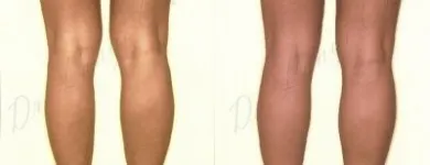 239 üzleti kép ZSÍRLESZÍVÁS KLINIKA DR LÁNYI CECÍLIA Plasztikai sebészet ban/ben Budapest