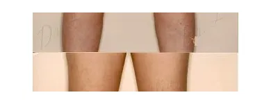 241 üzleti kép ZSÍRLESZÍVÁS KLINIKA DR LÁNYI CECÍLIA Plasztikai sebészet ban/ben Budapest