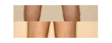 242 üzleti kép ZSÍRLESZÍVÁS KLINIKA DR LÁNYI CECÍLIA Plasztikai sebészet ban/ben Budapest