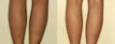 243 üzleti kép ZSÍRLESZÍVÁS KLINIKA DR LÁNYI CECÍLIA Plasztikai sebészet ban/ben Budapest