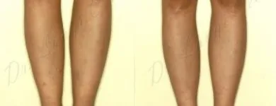 244 üzleti kép ZSÍRLESZÍVÁS KLINIKA DR LÁNYI CECÍLIA Plasztikai sebészet ban/ben Budapest