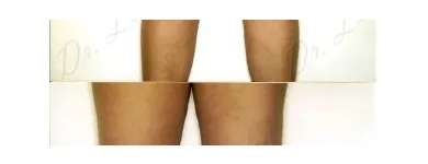 245 üzleti kép ZSÍRLESZÍVÁS KLINIKA DR LÁNYI CECÍLIA Plasztikai sebészet ban/ben Budapest