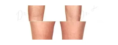 247 üzleti kép ZSÍRLESZÍVÁS KLINIKA DR LÁNYI CECÍLIA Plasztikai sebészet ban/ben Budapest