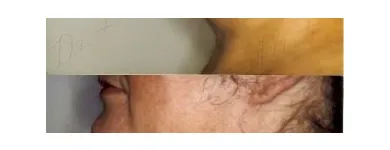 248 üzleti kép ZSÍRLESZÍVÁS KLINIKA DR LÁNYI CECÍLIA Plasztikai sebészet ban/ben Budapest