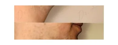 249 üzleti kép ZSÍRLESZÍVÁS KLINIKA DR LÁNYI CECÍLIA Plasztikai sebészet ban/ben Budapest